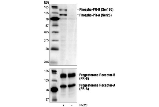 Western Blotting Image 1: Phospho-Progesterone Receptor (Ser190) Antibody