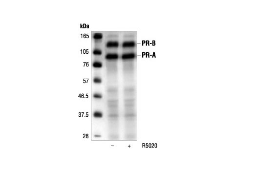 Western Blotting Image 1: Progesterone Receptor (6A1) Mouse mAb