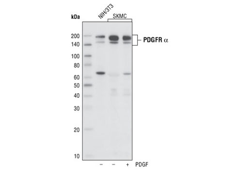 Western Blotting Image 1: PDGF Receptor α (D1E1E) XP® Rabbit mAb