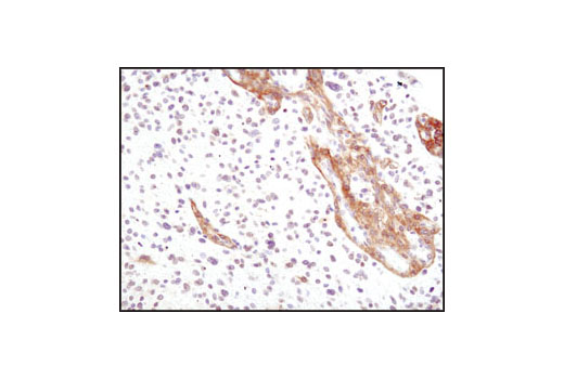  Image 6: PDGF Receptor α Antibody Sampler Kit