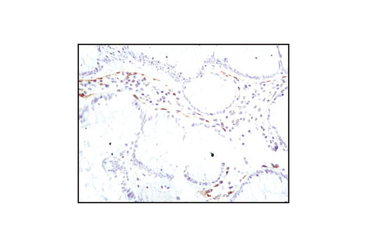 Immunohistochemistry Image 2: PDGF Receptor α (D1E1E) XP® Rabbit mAb