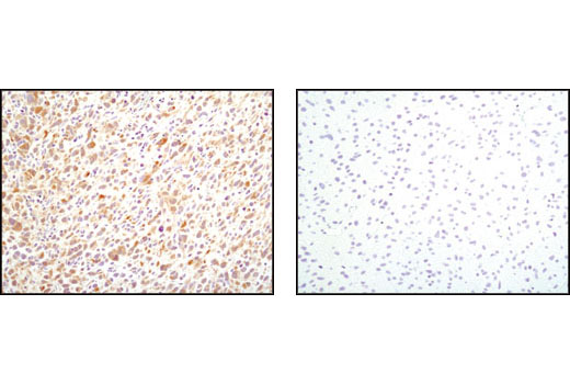Immunohistochemistry Image 3: PDGF Receptor α (D1E1E) XP® Rabbit mAb
