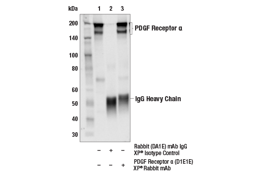 Immunoprecipitation Image 1: PDGF Receptor α (D1E1E) XP® Rabbit mAb