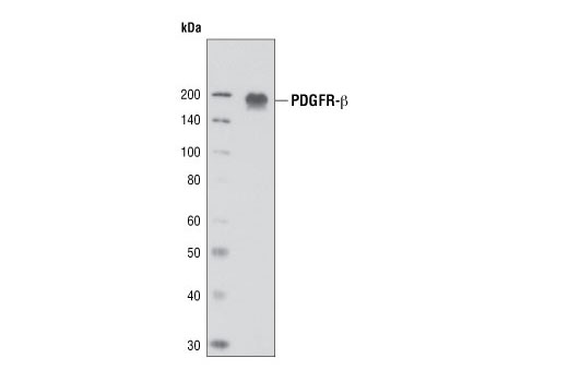 Western Blotting Image 1: PDGF Receptor β (2B3) Mouse mAb