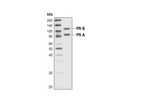 Western Blotting Image 1: Progesterone Receptor A/B Antibody