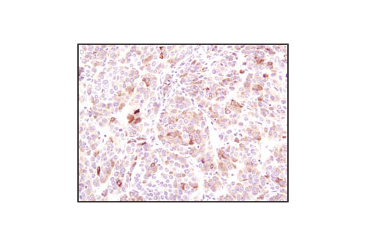  Image 28: HSP/Chaperone Antibody Sampler Kit