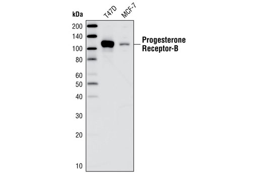 Western Blotting Image 1: Progesterone Receptor B Antibody