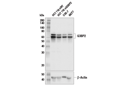 Western Blotting Image 2: G3BP2 Antibody