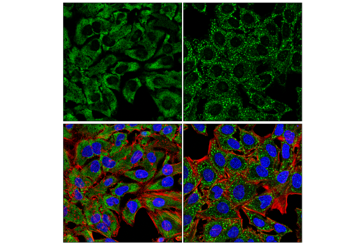 Immunofluorescence Image 1: G3BP2 Antibody