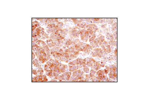 Immunohistochemistry Image 2: Fatty Acid Synthase (C20G5) Rabbit mAb