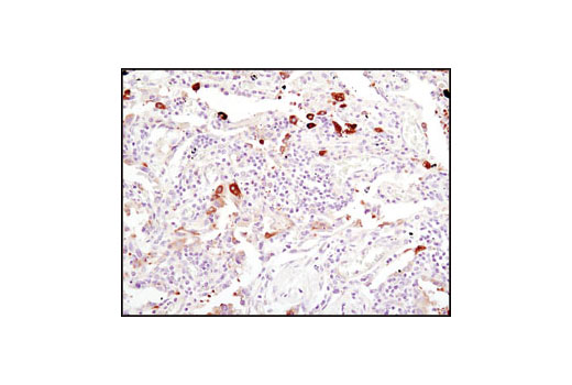 Immunohistochemistry Image 3: Fatty Acid Synthase (C20G5) Rabbit mAb