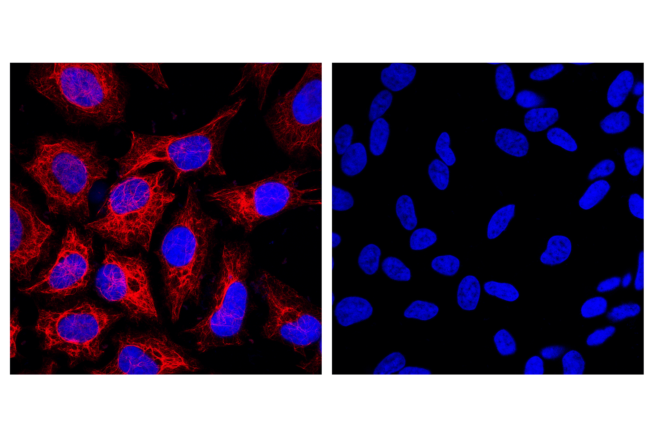Immunofluorescence Image 1: Pan-Keratin (C11) Mouse mAb (Alexa Fluor® 594 Conjugate)