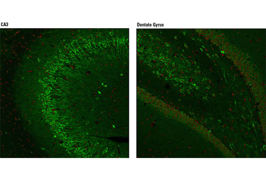 Immunofluorescence Image 1: Huntingtin (D7F7) XP® Rabbit mAb (BSA and Azide Free)