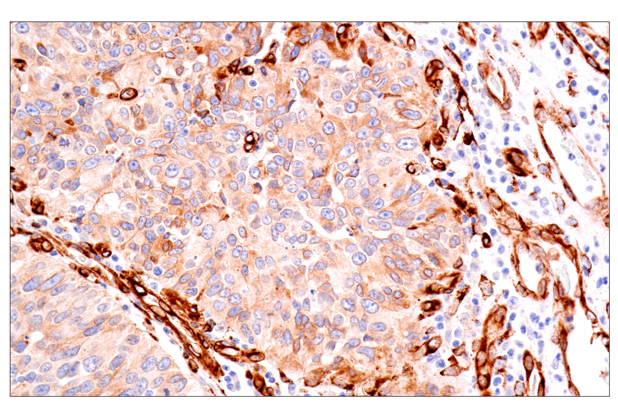 Immunohistochemistry Image 4: HSP47/SERPINH1 (E4A8P) Rabbit mAb