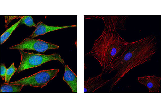 Immunofluorescence Image 1: NQO1 (A180) Mouse mAb