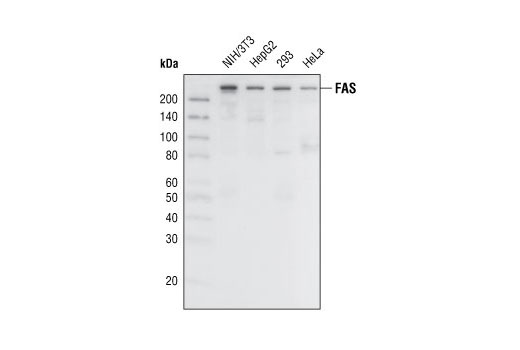 Western Blotting Image 1: Fatty Acid Synthase Antibody