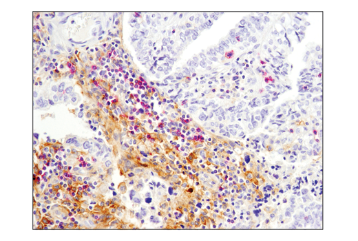 Immunohistochemistry Image 1: SignalStain® Boost IHC Detection Reagent (AP, Mouse)