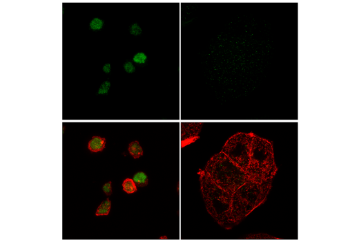 Immunofluorescence Image 1: GFI1 (E5J6J) Rabbit mAb