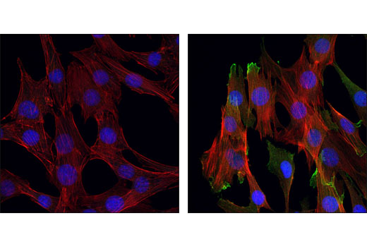 Immunofluorescence Image 1: Phospho-Akt (Ser473) (D9E) XP® Rabbit mAb (BSA and Azide Free)