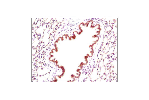  Image 42: Epithelial-Mesenchymal Transition (EMT) IF Antibody Sampler Kit
