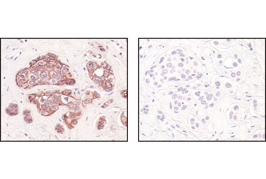 Immunohistochemistry Image 10: E-Cadherin (24E10) Rabbit mAb