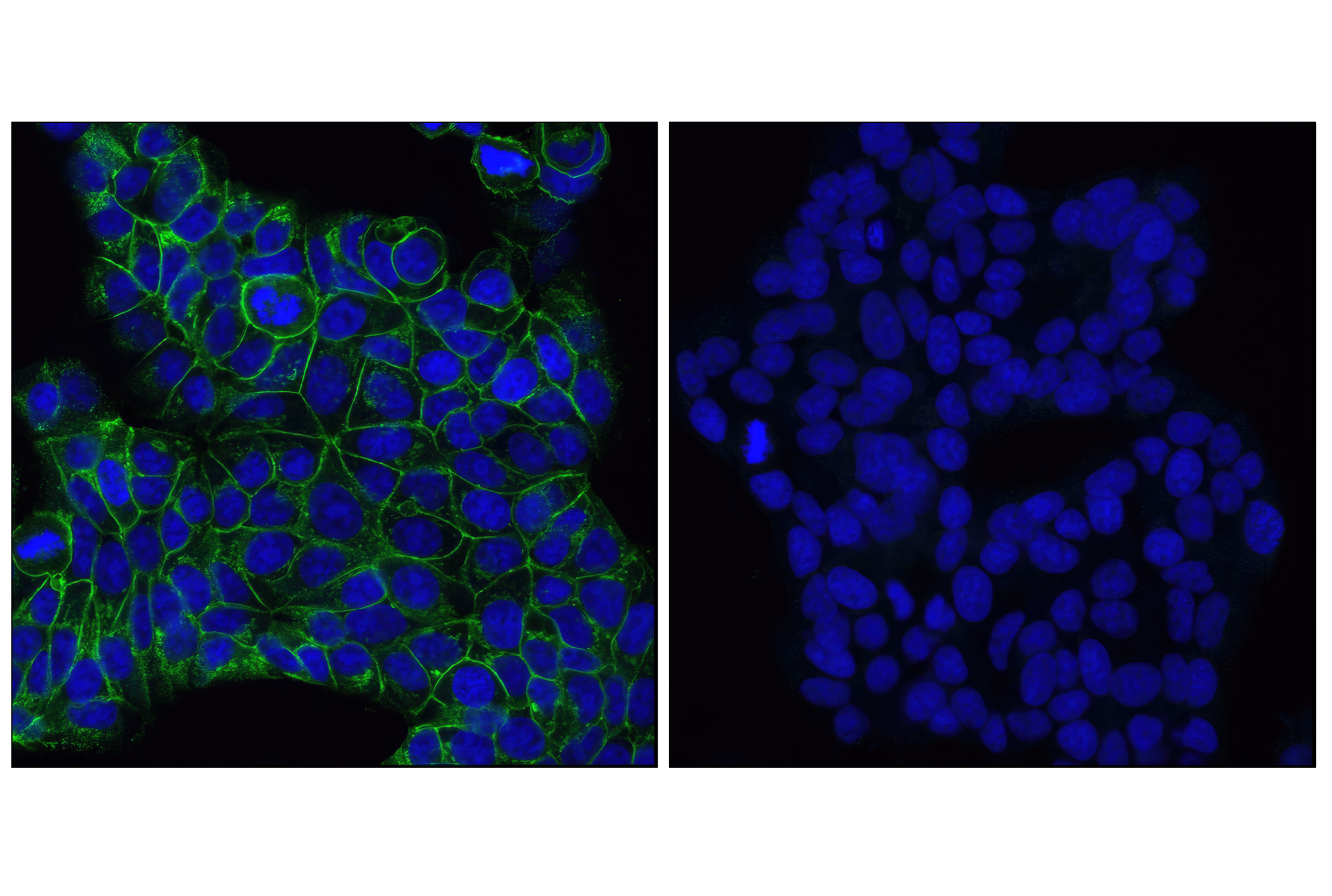 Immunofluorescence Image 1: E-Cadherin (24E10) Rabbit mAb