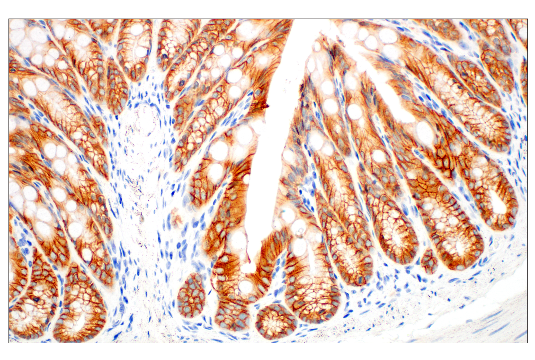 Immunohistochemistry Image 7: E-Cadherin (24E10) Rabbit mAb