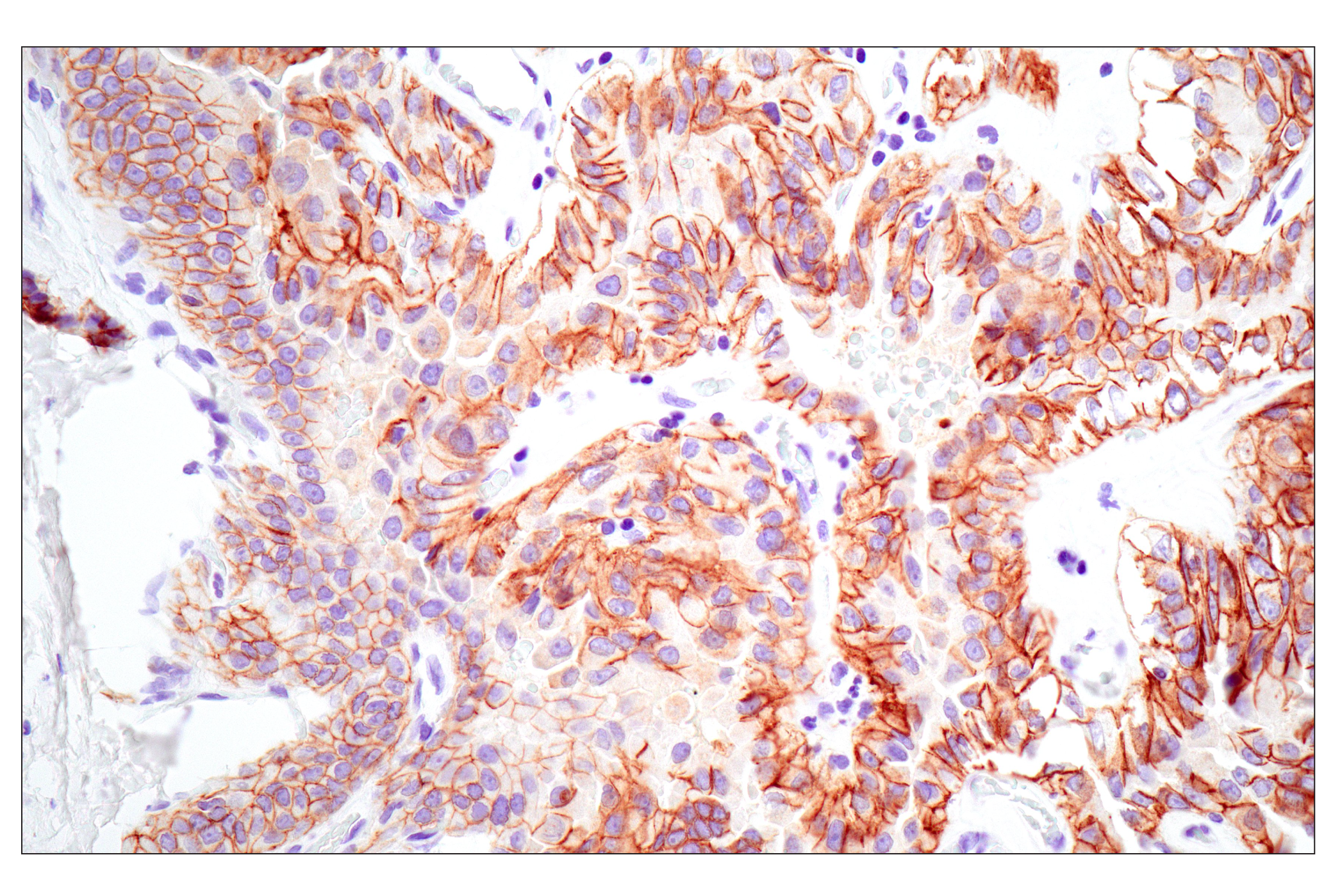  Image 19: Epithelial-Mesenchymal Transition (EMT) IF Antibody Sampler Kit