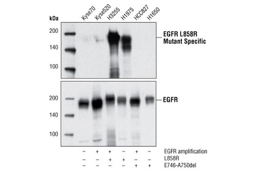 Western Blotting Image 1: EGF Receptor (L858R Mutant Specific) (43B2) Rabbit mAb