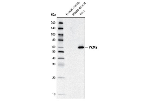 Western Blotting Image 1: PKM2 Antibody