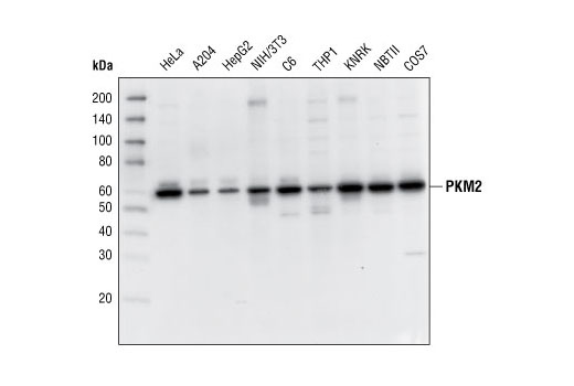 Western Blotting Image 2: PKM2 Antibody