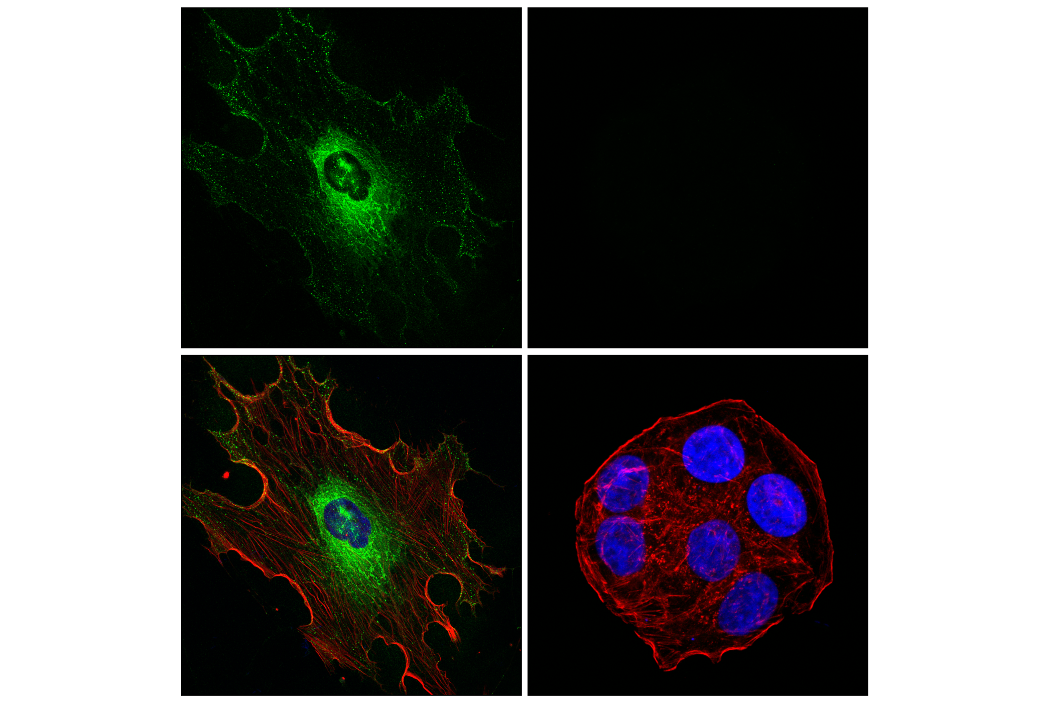 Immunofluorescence Image 1: CEMIP (E8Y4R) Rabbit mAb