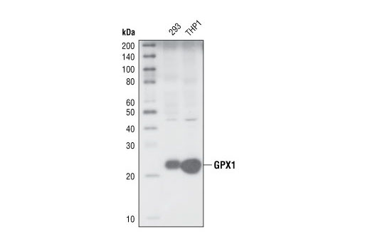 Western Blotting Image 1: GPX1 Antibody