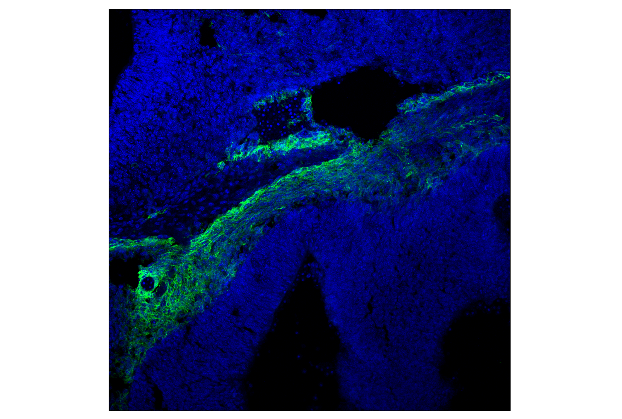 Immunofluorescence Image 2: p75NTR (F2L9S) Rabbit mAb (BSA and Azide Free)