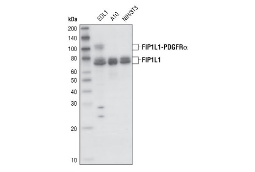 Western Blotting Image 1: FIP1L1 Antibody