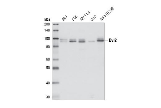 Western Blotting Image 1: Dvl2 Antibody