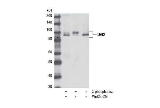 Western Blotting Image 2: Dvl2 Antibody