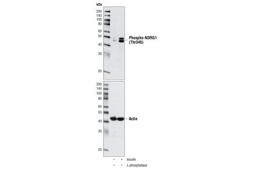 Western Blotting Image 1: Phospho-NDRG1 (Thr346) Antibody