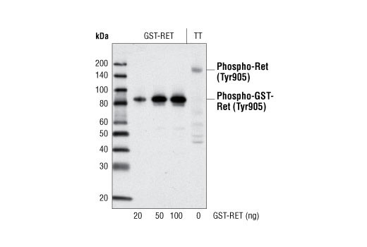 Western Blotting Image 1: Phospho-Ret (Tyr905) Antibody