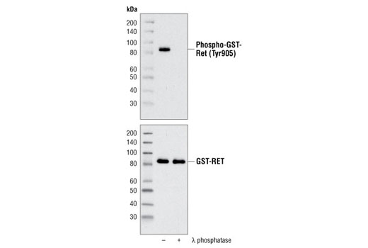 Western Blotting Image 2: Phospho-Ret (Tyr905) Antibody