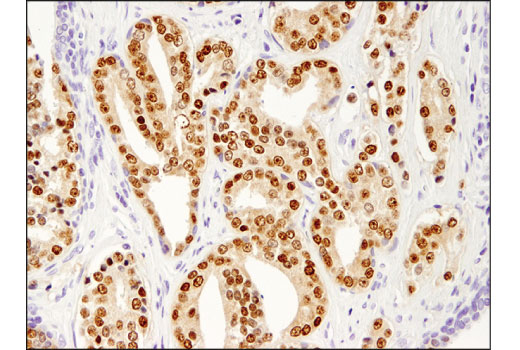 Immunohistochemistry Image 3: NKX3.1 (D6D2Z) XP® Rabbit mAb (BSA and Azide Free)