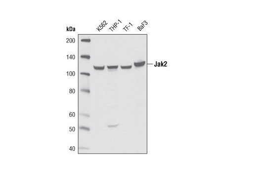  Image 3: PhosphoPlus® Jak2 (Tyr1007/Tyr1008) Antibody Duet
