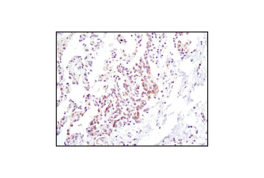  Image 22: IFN-γ Signaling Pathway Antibody Sampler Kit