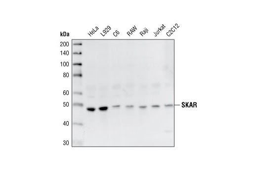 Western Blotting Image 1: SKAR Antibody