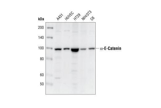 Western Blotting Image 1: α-E-Catenin Antibody