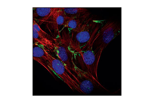 Immunofluorescence Image 1: Caveolin-1 Antibody