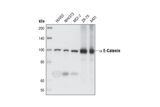 Western Blotting Image 1: α-E-Catenin (23B2) Rabbit mAb