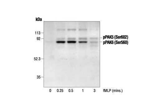 Western Blotting Image 1: Phospho-PAK4 (Ser474)/PAK5 (Ser602)/PAK6 (Ser560) Antibody