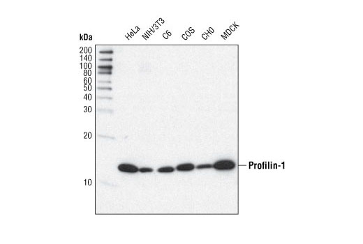  Image 3: Actin Nucleation and Polymerization Antibody Sampler Kit