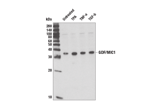 Western Blotting Image 1: GDF15/MIC1 (Y60) Antibody